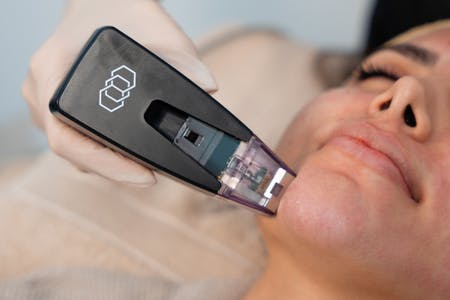 Morpheus Red Light Rejuvenation  preview