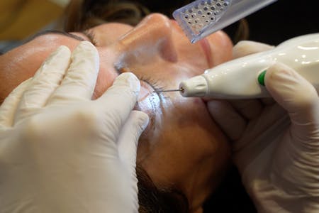 Eyelid Plexr preview